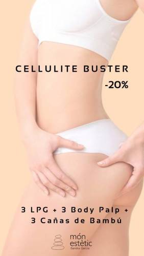 Cellulite Buster' title='Cellulite Buster